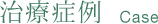 装置の種類